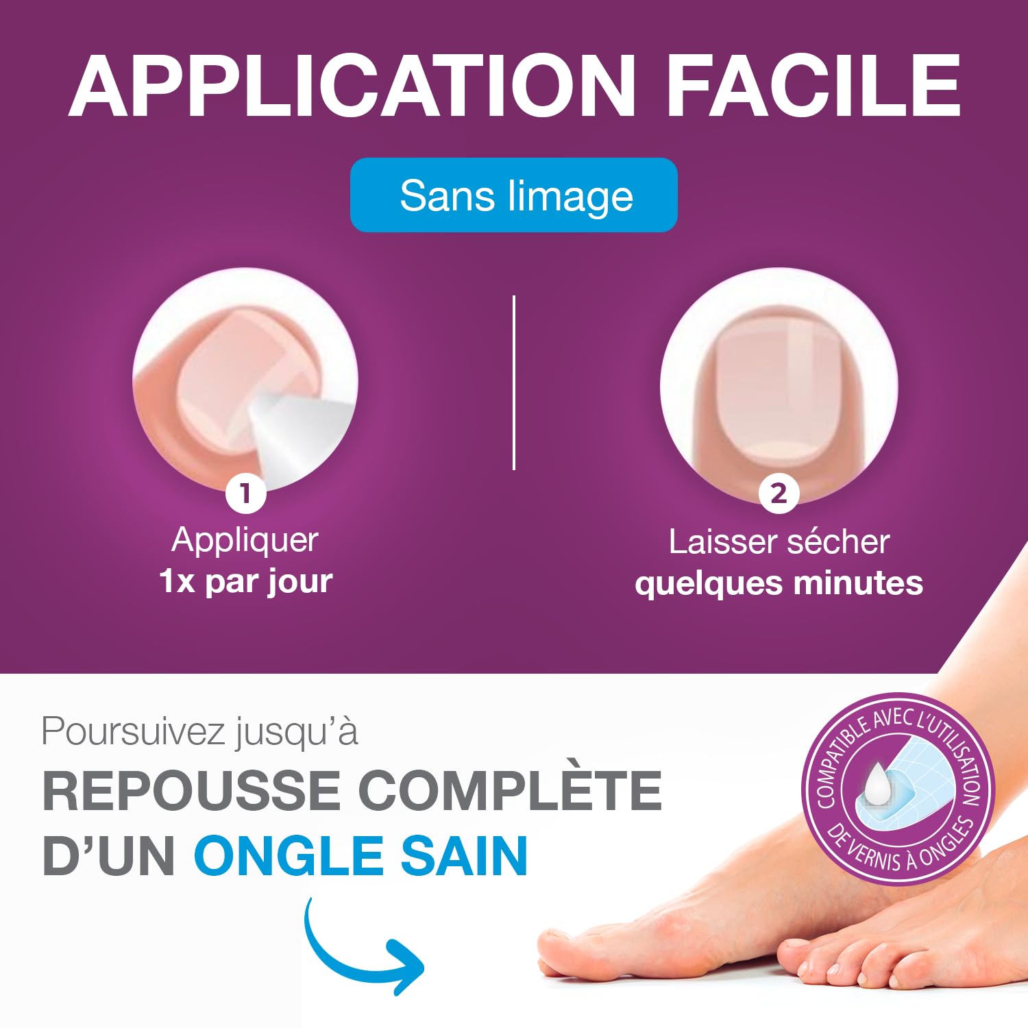 emtrix-ongle-traitement-mycose-ongle-pied-10-ml-sans-limage image 4