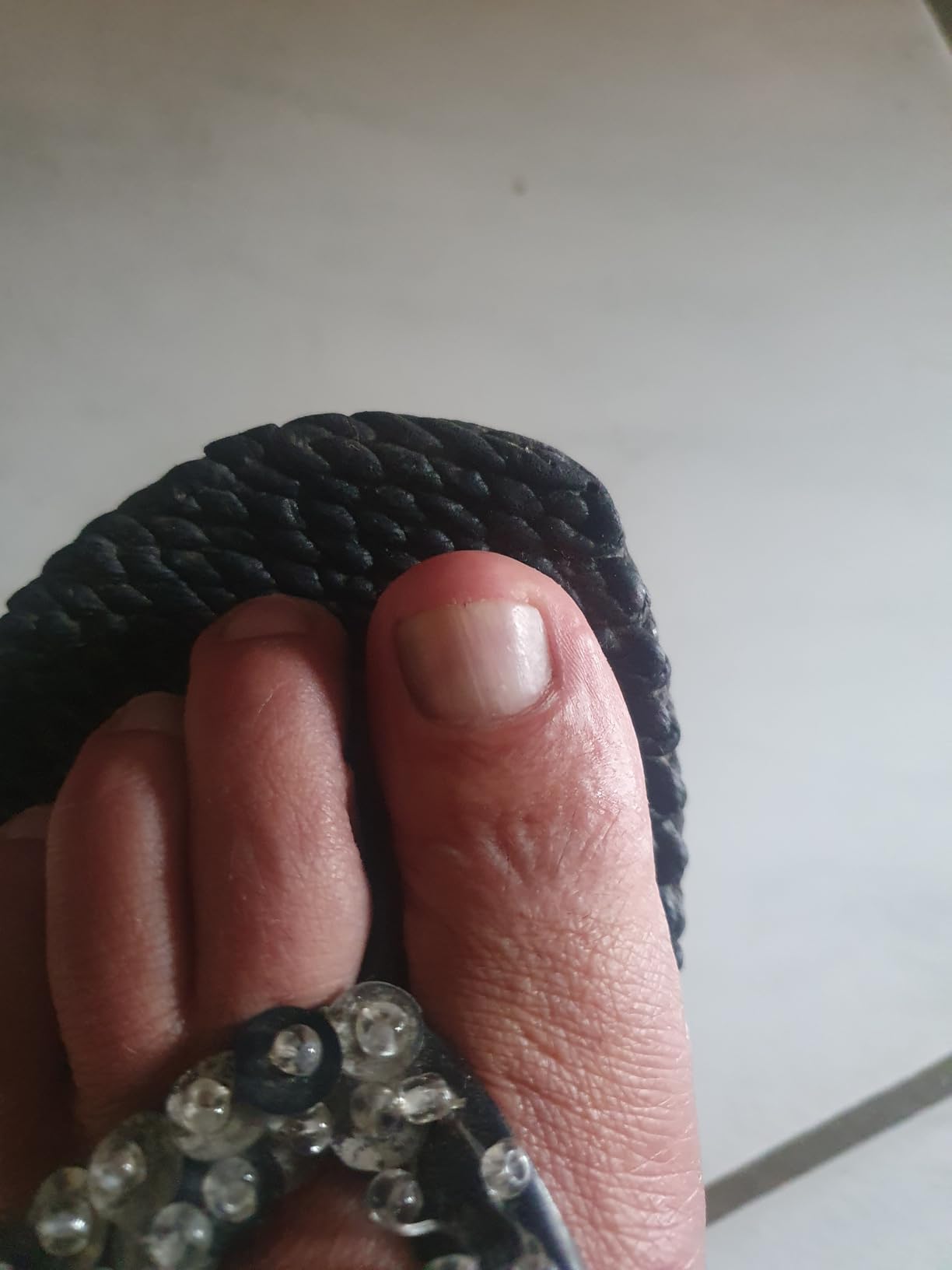 Ongle souple